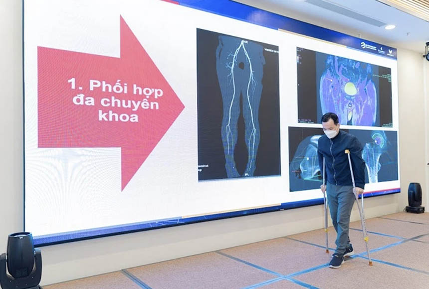 ứng dụng công nghệ in 3D trong phẫu thuật điều trị ung thư xương