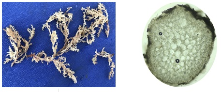 Hình 1: Hình thái (A) và hình cắt ngang quan sát dưới kính hiển vi (B) mẫu rong Laurencia intermedia Yamada sử dụng trong nghiên cứu