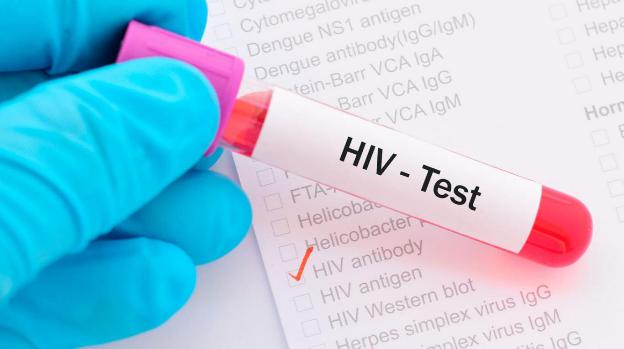 test hiv