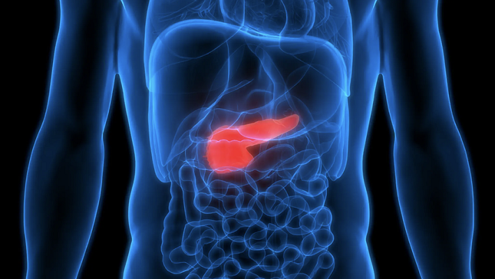 Minh họa ung thư tuyến tụy phát triển trong cơ thể bệnh nhân. Ảnh: iStock