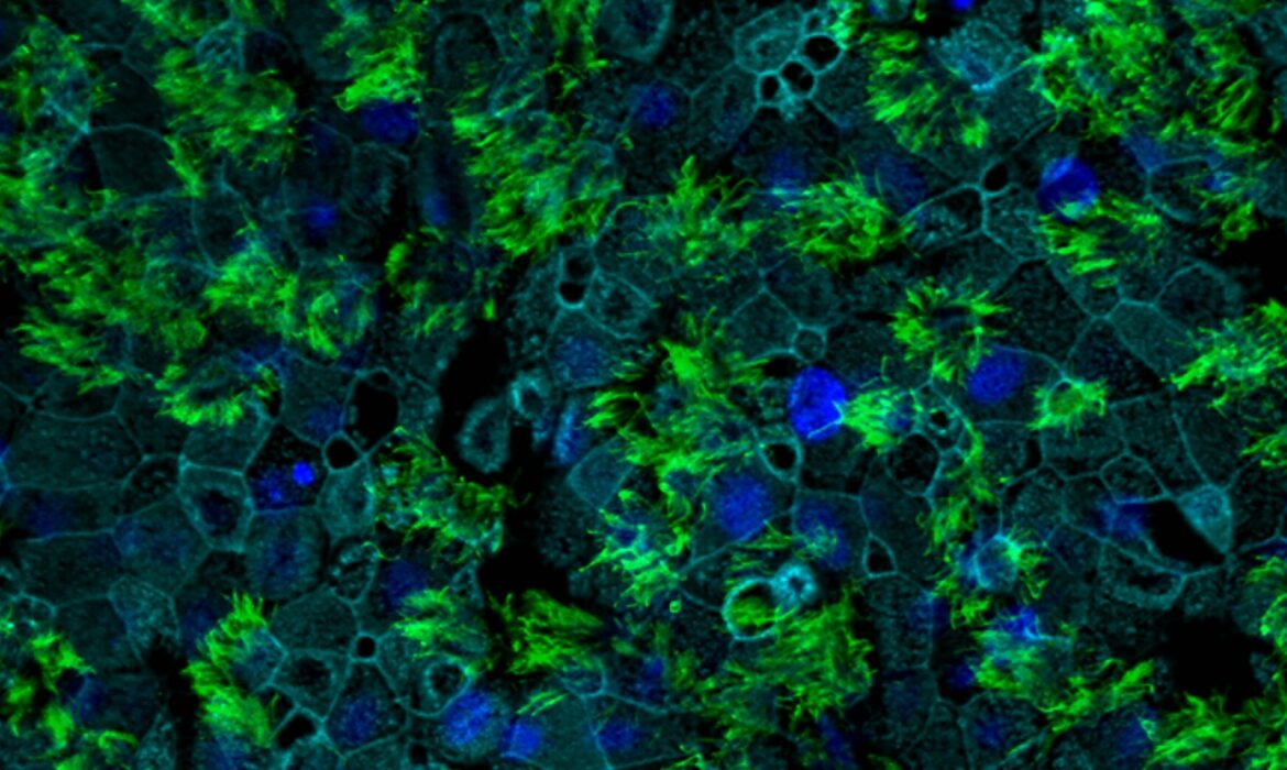 Phát hiện mới về các thụ thể khiến virus corona dễ xâm nhập tế bào người