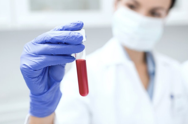Xét nghiệm máu giúp phát hiện tám loại ung thư