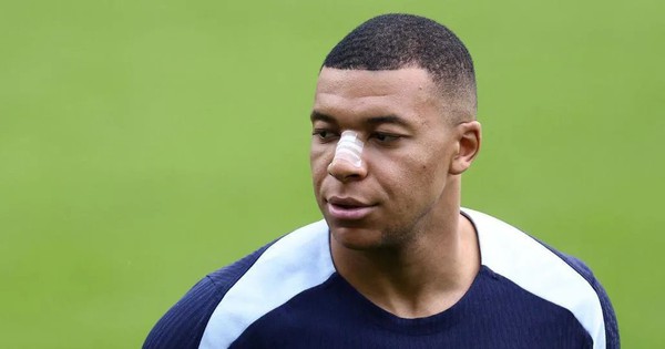 Hình ảnh mới nhất của sao Pháp: ‘Gãy mũi không phải tận thế, Mbappe trở lại rồi đây!’