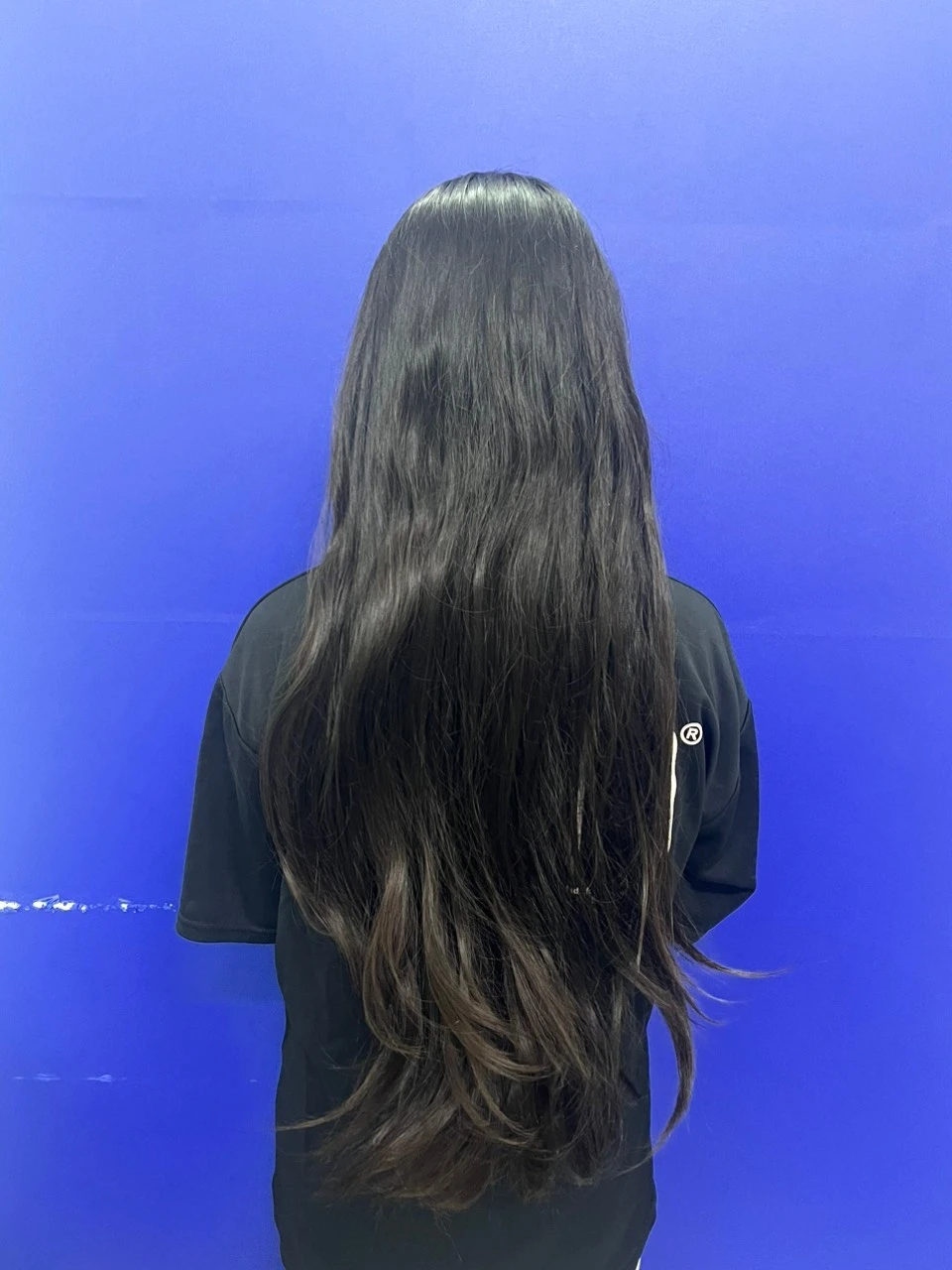 Bé gái bị vướng tóc vào bánh xe lột hoàn toàn da đầu hồi phục kỳ diệu - Ảnh 2.
