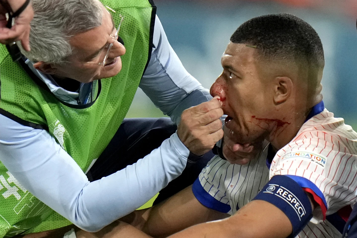 Hình ảnh mới nhất của sao Pháp: ‘Gãy mũi không phải tận thế, Mbappe trở lại rồi đây!’- Ảnh 1.