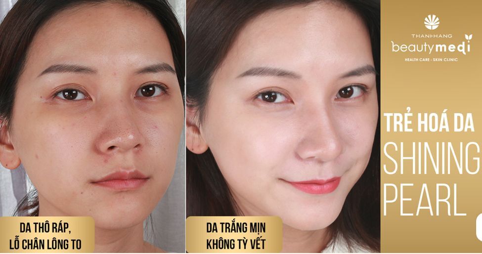 Thanh Hang Beauty Medi